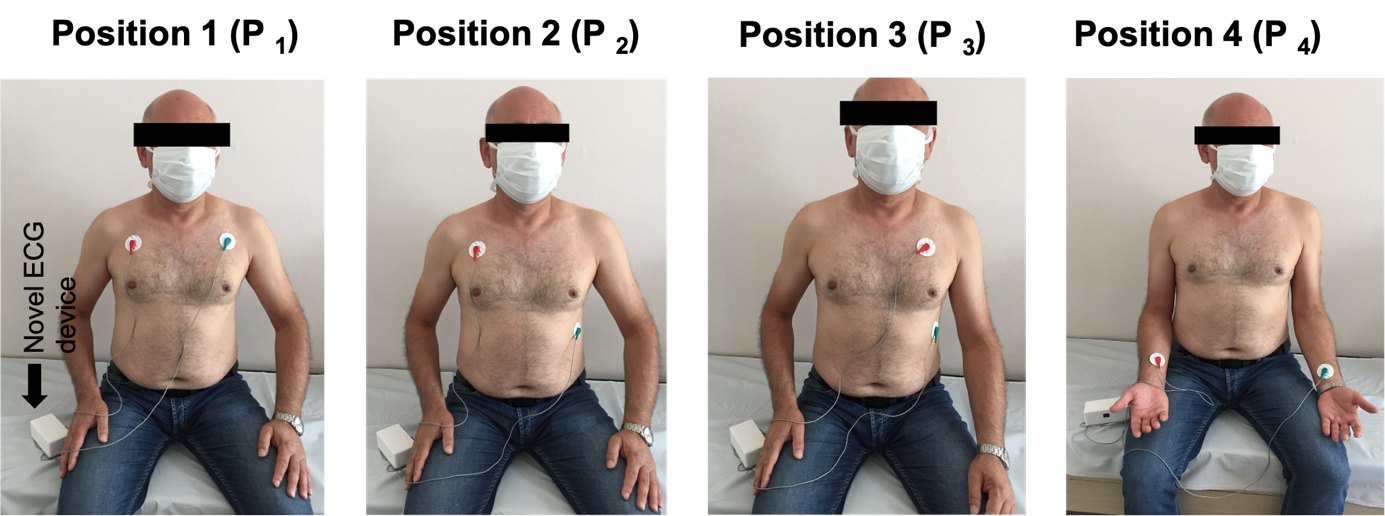 Farklı elektrot yerleşim pozisyonları P1, P2, P3 ve P4