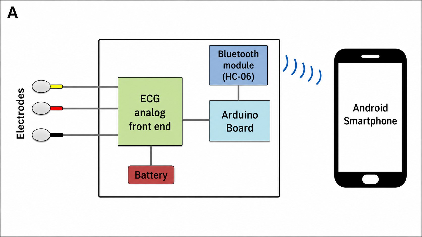 Elektrotlardan gelen sinyalin EKG modülü, Arduino ve Bluetooth üzerinden Android telefona aktarılmasını gösteren şema